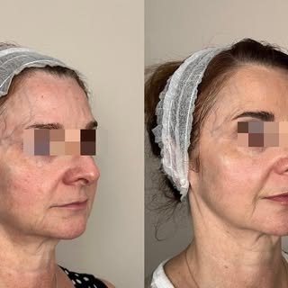 💫 Transformation through consistency 💫
With the right blend of treatments and a commitment to self