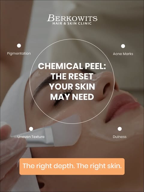 Chemical peels use controlled exfoliation to remove damaged surface cells and support skin renewal. 