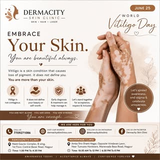 🌍 World Vitiligo Day | June 25

Vitiligo is not contagious. It is not caused by poor hygiene. Most 
