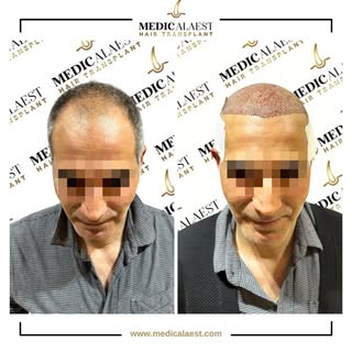 The journey to a new you starts here. 🚀

From planning to procedure, we focus on results that look 