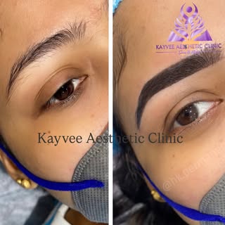 @kayvee_skinhair_aesthetic and Laser Clinic, our expert microblading eyebrows treatment creates natu