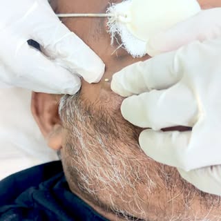 @kayvee_skinhair_aesthetic Painless fatty lumps removal by experienced specialists with faster recov