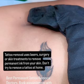 @kayvee_skinhair_aesthetic Best Tattoo Removal in city , 
Choosing the best skin clinic in Chennai f