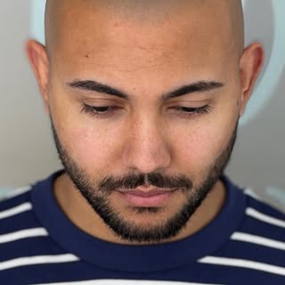 Feel like yourself again this summer.
Scalp Micropigmentation by Marcin Adam at MicroHair® Liverpool