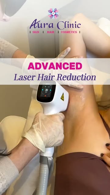 Say goodbye to unwanted hair with advanced hair reduction treatment! 💗✨

Tired of frequent shaving,
