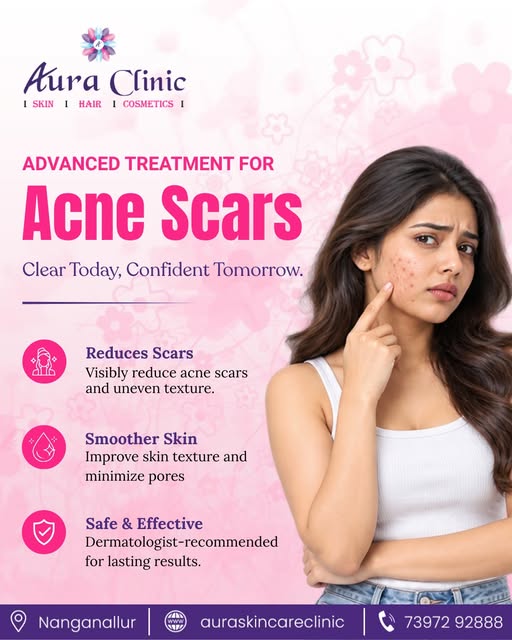 ✨ Say Goodbye to Acne Scars & Reveal Smoother-Looking Skin! ✨

Acne may fade, but the scars it leave