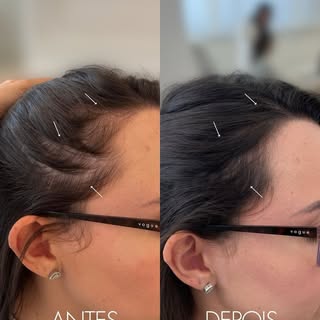 Todo paciente aqui já tinha tentado antes shampoo, vitamina, indicação de alguém... 

Foi apenas com