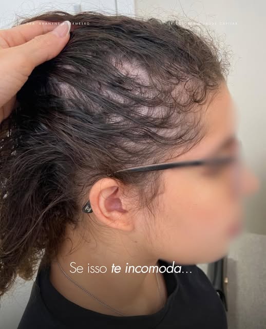 Se você se reconheceu nessas imagens de antes, já percebeu o afinamento ou a queda dos seus fios.

E