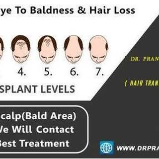 # Hair Loss Problem