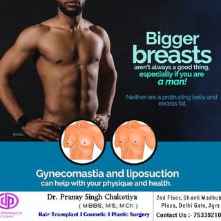 #gynecomastia
