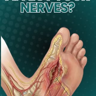 Neuropathy can affect nerves, muscles, and joints — making movement difficult and reducing sensation