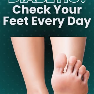 If you have diabetes, a few simple daily steps can help protect your feet and prevent serious compli