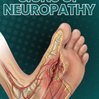Diabetic neuropathy can silently damage the nerves and reduce the ability to feel pain, heat, or inj