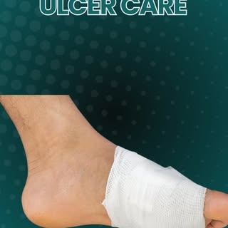 In ulcer care, simply bandaging and covering the wound is not enough.

The next important step is pr