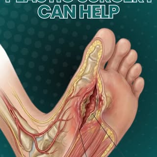 Wounds involving important structures such as bones, tendons, blood vessels, or nerves, especially w