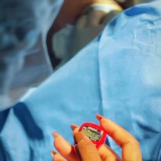 #transplantecapilar #hairtransplant