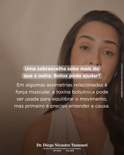 Quase nenhum rosto é perfeitamente simétrico. E isso é normal.

Mas algumas assimetrias ficam mais e