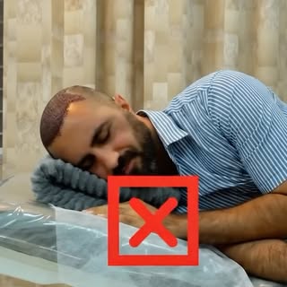 Your grafts need protection, not pressure.

How you sleep in the first week decides your final densi