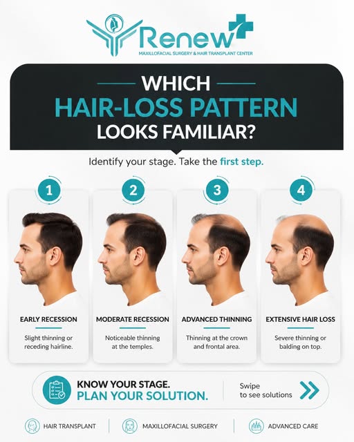 Which hair-loss pattern looks familiar?

Hair loss is often a gradual process, which is why many peo