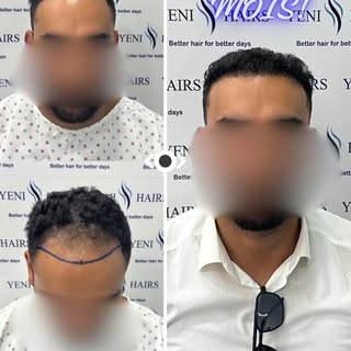 واش كتأجل القرار حيت خايف النتيجة تبان "مزروعة" وماشي طبيعية؟
هاد الصورة غادي تبدّل رأيك... 9 أشهر ف