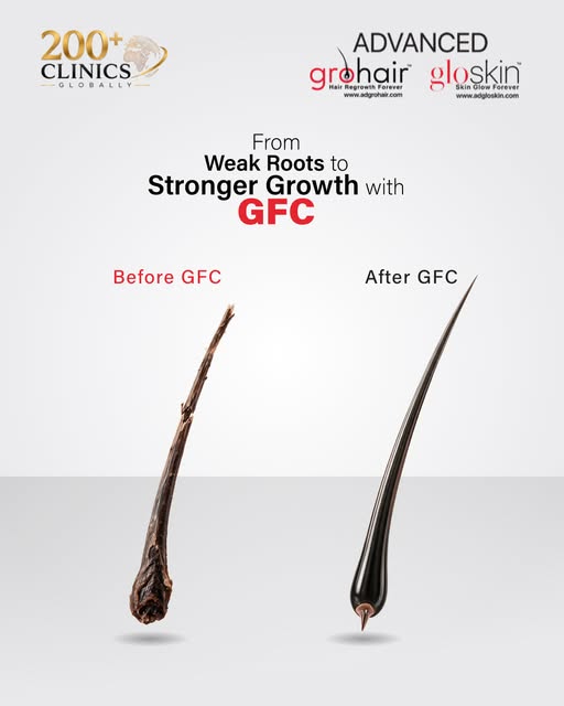 Stronger roots. Healthier hair. Renewed confidence. 

Give your hair the support it needs with GFC H