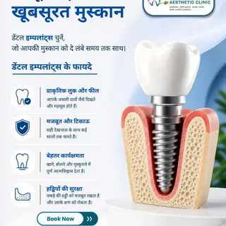 मजबूत दाँत, खूबसूरत मुस्कान!

खोया हुआ दाँत अब आपकी मुस्कान और आत्मविश्वास को नहीं रोकेगा।
डेंटल इम्