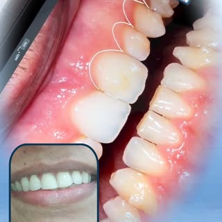 A beautiful smile can transform your confidence—and nothing speaks louder than a happy patient's exp