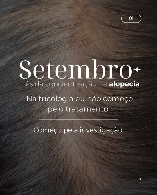 Setembro é um mês para falar sobre alopecia. 
Mas, principalmente, para falar sobre informação e dia