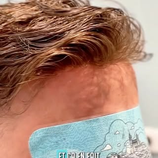 Il voulait des cheveux, il a trouvé cette solution. La prothèse capillaire Katsura, disponible sur n