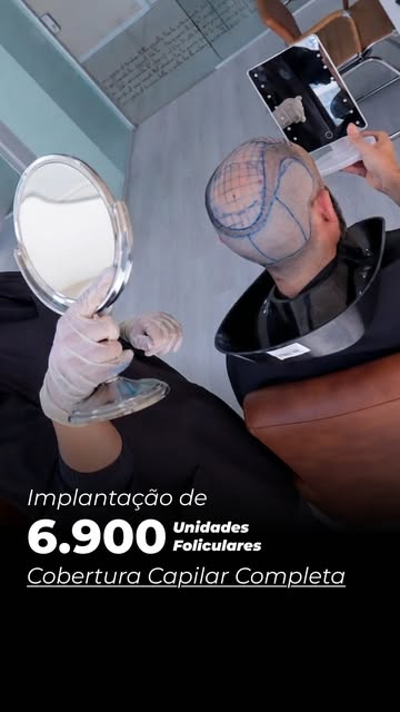 O Iugor chegou para o transplante com aquele frio na barriga que tanta gente sente. Mas bastou conve