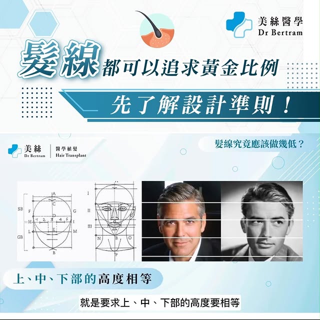 【髮線都可以追求黃金比例📐？先了解設計準則👨🏻‍🏫！】

髮線上移係好多男士👨🏻都會面臨嘅問題，雄激素遺傳性脫髮、頭髮護理不當牽拉性脫髮、意外或手術疤痕脫髮等，都係髮線上移比較常見嘅原因。