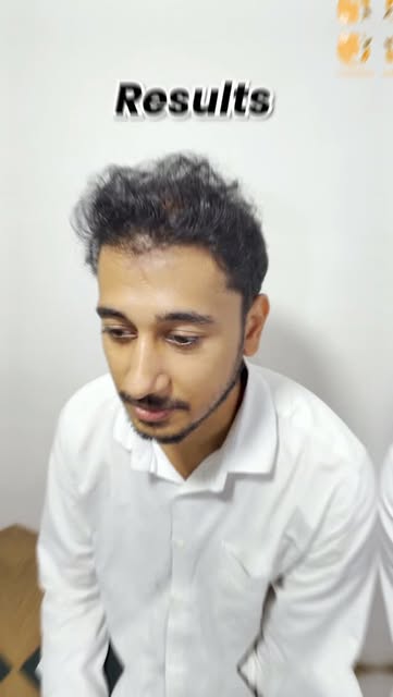 From thinning to a fuller-looking hairline ✨
A transformation that speaks for itself! 💯

Watch Aziz