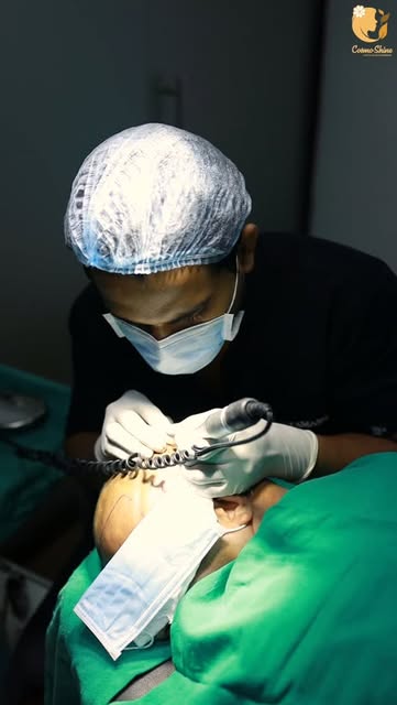 From hair loss to a confident new look! ✨
Hair transplant can help restore your hairline and confide
