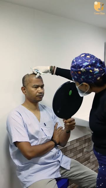 A new hairline, a new confidence! ✨
Precision hair transplant designed for a natural-looking transfo