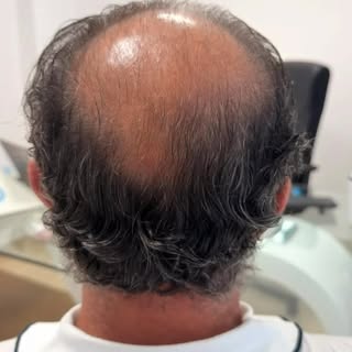 Ennesimo caso di successo…
Oggi è stato il turno di Santo un signore Italiano residente in Svizzera 