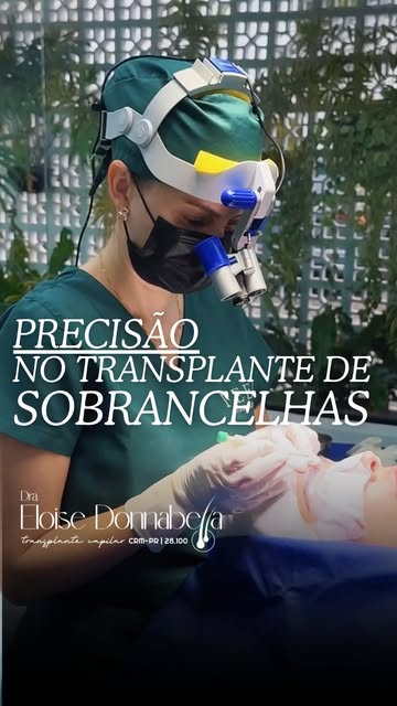 Nesse vídeo, eu mostro um pouco do passo a passo do transplante de sobrancelhas e explico por que ca