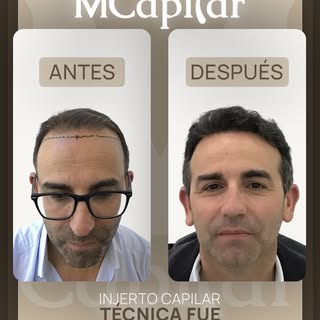 Desliza para ver 𝘂𝗻 𝗰𝗮𝗺𝗯𝗶𝗼 𝗿𝗲𝗮𝗹.

“Fue decisión exclusivamente mía. Quería un cambio.”

