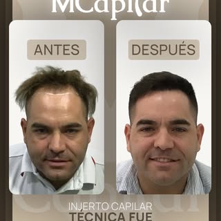 Desliza para ver 𝘂𝗻 𝗰𝗮𝗺𝗯𝗶𝗼 𝗿𝗲𝗮𝗹.

Detrás de cada evolución hay una planificación médica 