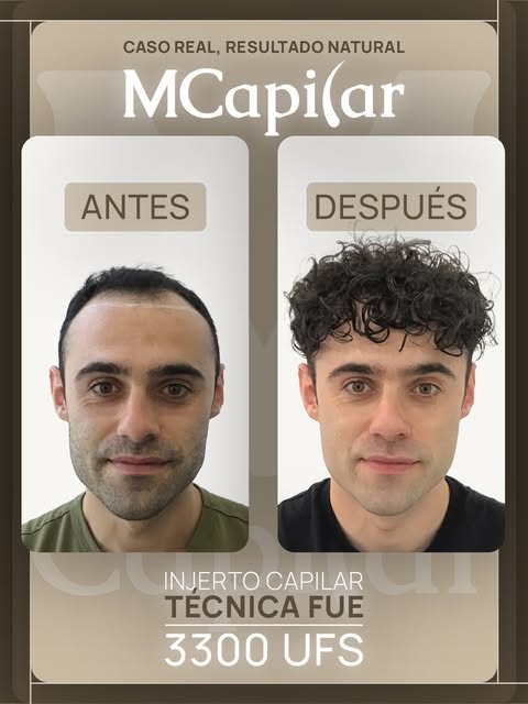 Desliza para ver 𝘂𝗻 𝗰𝗮𝗺𝗯𝗶𝗼 𝗿𝗲𝗮𝗹.

“Bufff… Hay mucho cambio, si.” 😄

Esto nos decía Álva