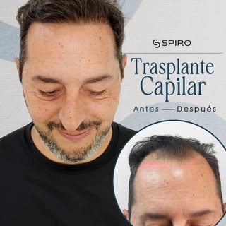 Tu cabello, tu seguridad.
No pospongas la versión de ti que quieres ver en el espejo. El momento de 