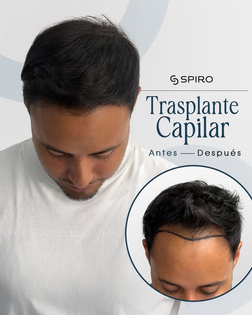 El verdadero cambio no se ve solo en el espejo, se siente en la actitud. 🔥 Restauramos esta zona co