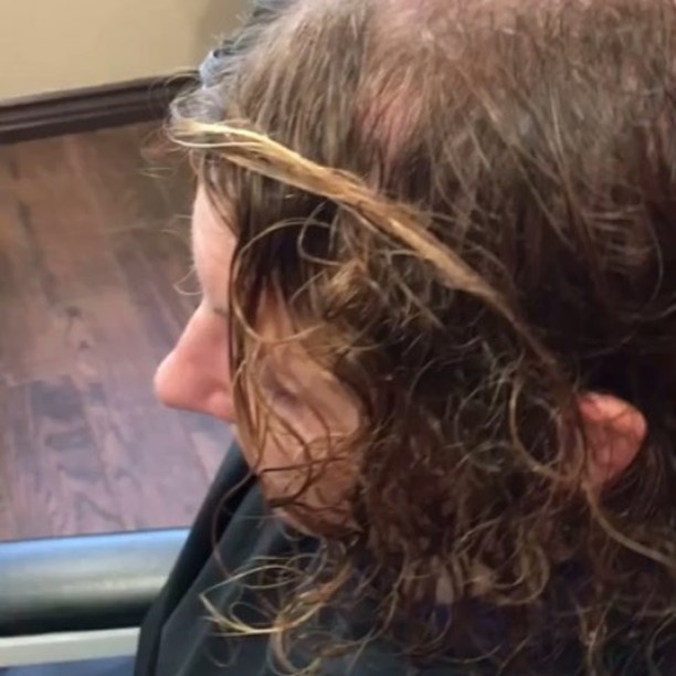 Amnon performs ITHL method visit RazHair.com