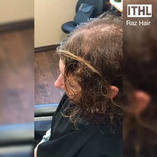 Thinning Hair can be resolved  Raz Hair Restoration Boutique  Learn more RazHair.com