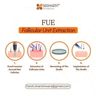 Say goodbye to hair loss with FUE (Follicular Unit Extraction) – a modern, pain-free solution for na