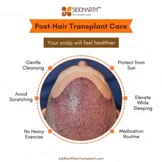 Healthy scalp, happy hair! Follow these simple post-transplant care tips for the best results. 🌟

A