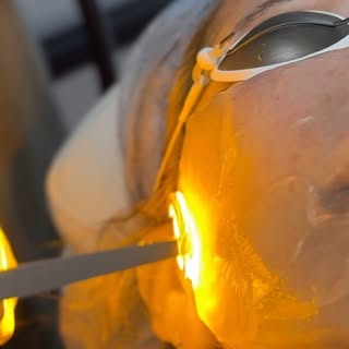 ADVATx is among the most sophisticated dermatology lasers on the market and it requires no numbing ❌