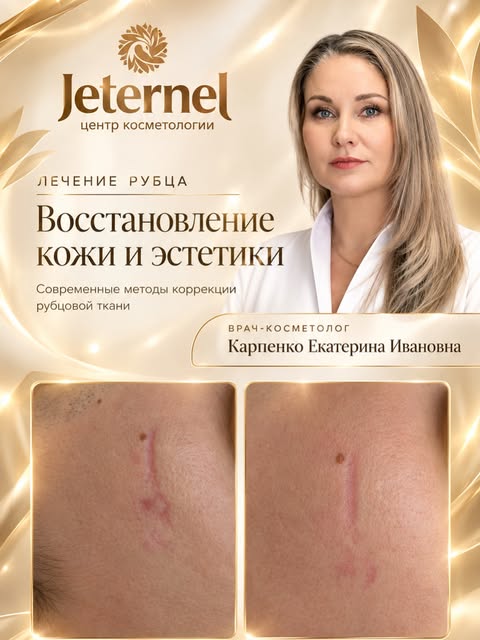 🧬 Как убрать шрам? История одного пациента

К нам обратился пациент с запросом — убрать шрам, котор