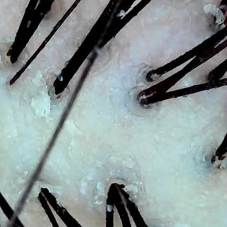 🚨 **YOUR SCALP IS TALKING... ARE YOU LISTENING?** 👀

Healthy hair starts with a healthy scalp. 🌿
