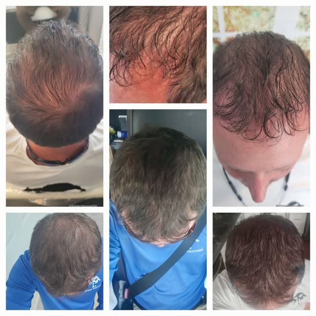 ✨ REAL CLIENT. REAL REGROWTH. 6 MONTHS. ✨

This is what 6 months of consistency and a personalized h