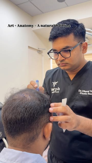 The most critical step in hair restoration happens before the first graft is placed. ✍️
Designing a 